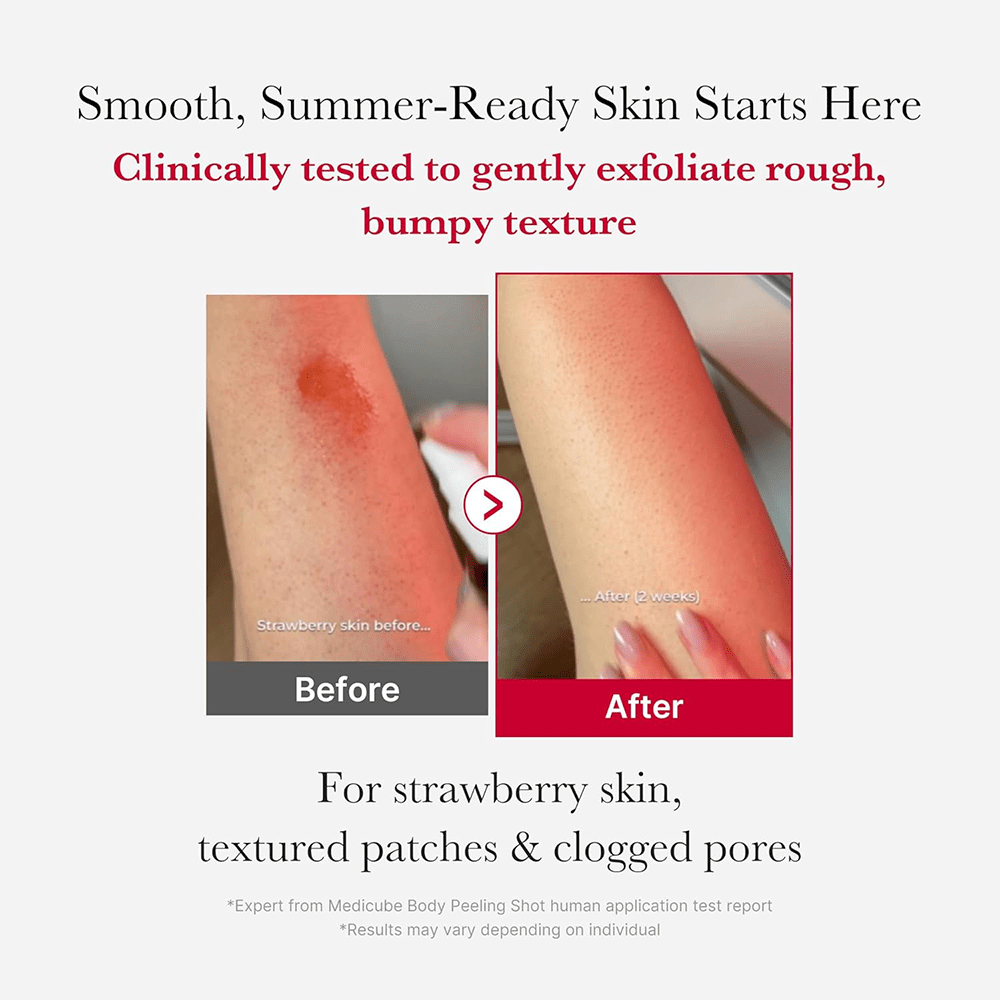 Medicube Red Body Peeling Shot AHA + BHA Exfoliating Body Spray 120ml