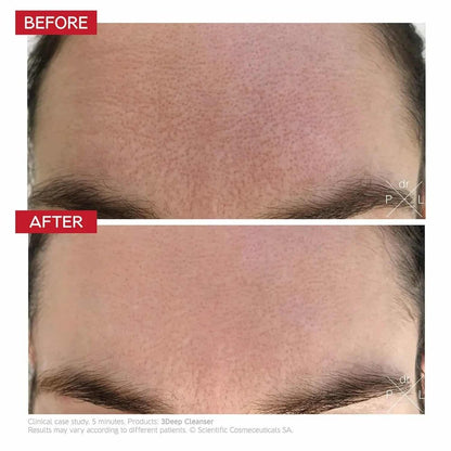 Dr. Levy 3 Deep Micro-resurfacing Cleanser 150ml