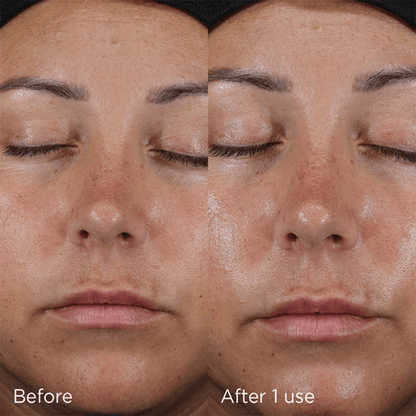 Image Skincare Daily Prevention Ultra Defense Moisturizer SPF 50 73g