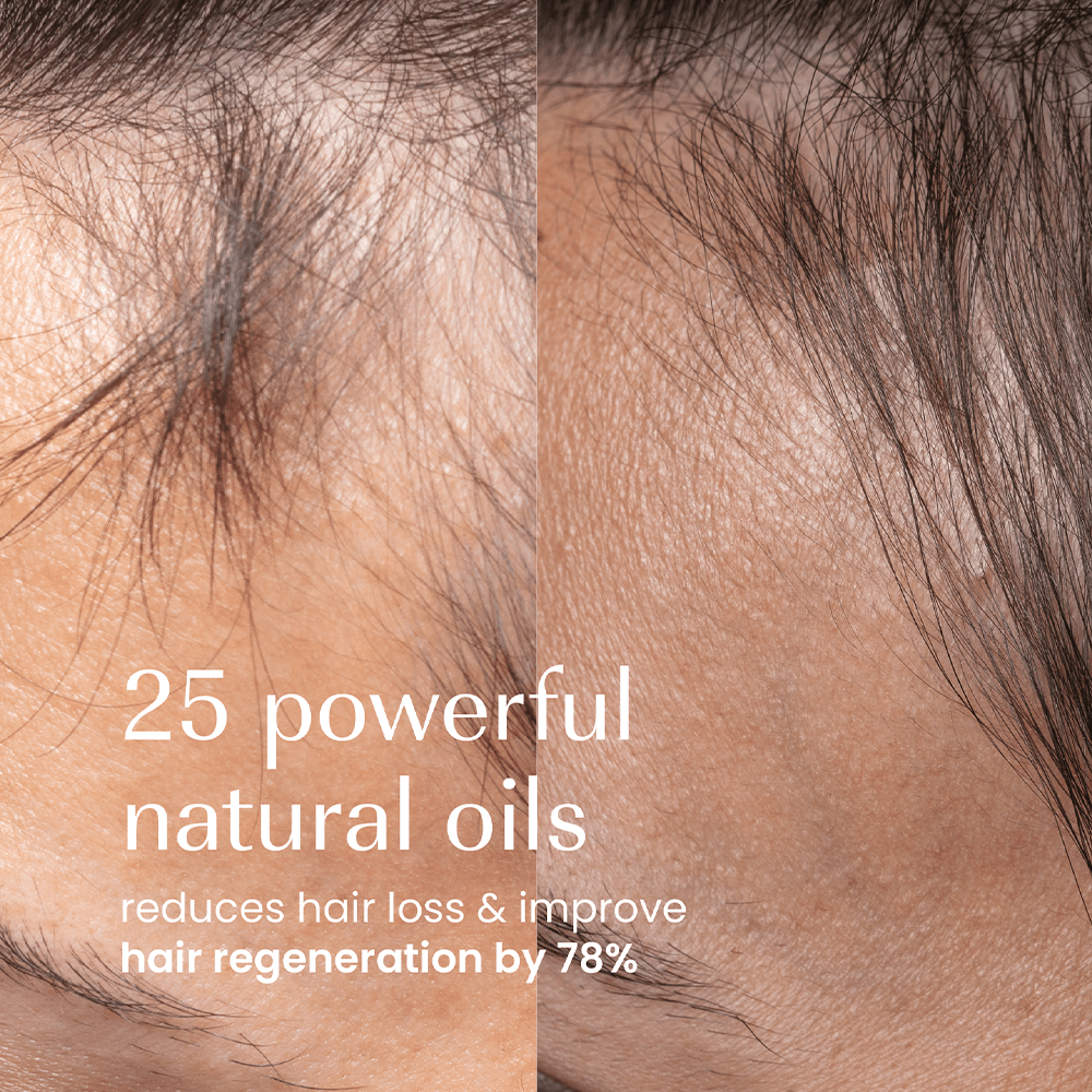 Izil Beauty Densify Strengthening Hair Oil 190ml