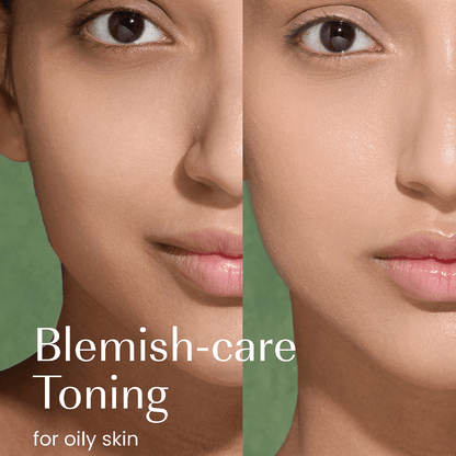 Izil Beauty Green Tea &amp; Salicylic Pore-Clarifying Toner 190ml