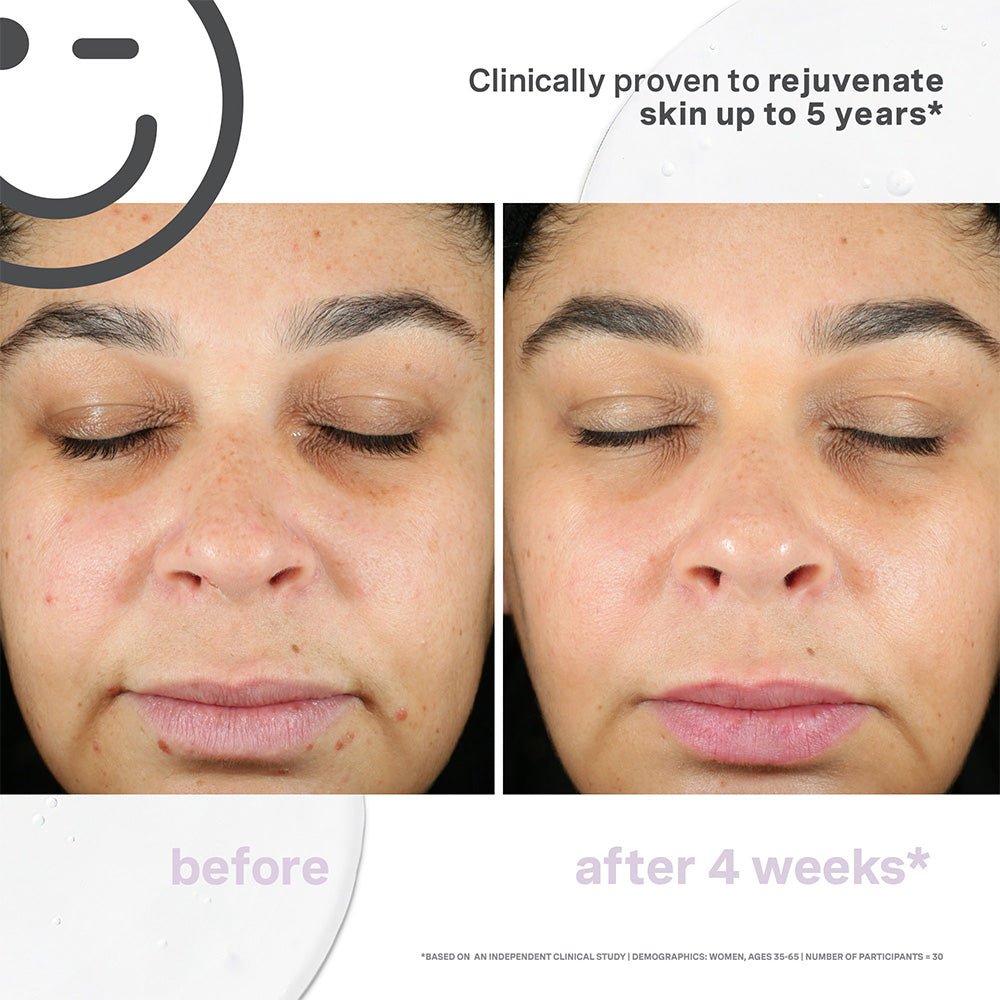 Kate Somerville Kateceuticals Supercell Rejuvenation Serum - 1oz/30