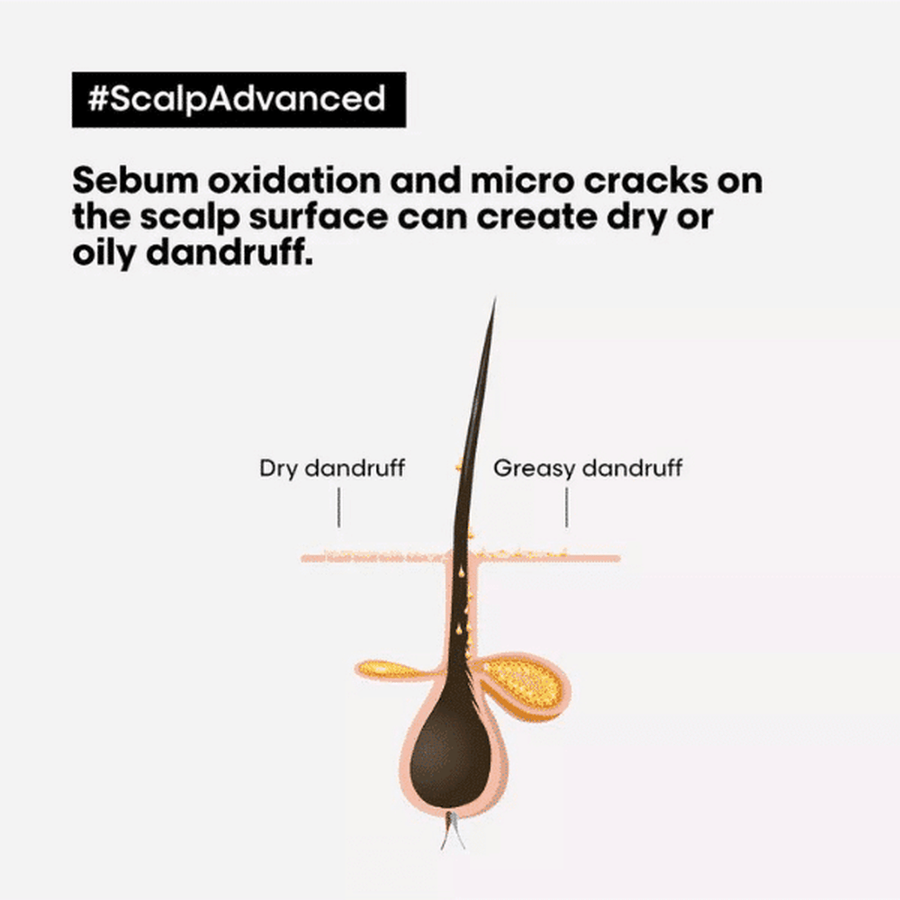 Serie Expert Scalp Advanced Anti-Dandruff Dermo-Clarifier Shampoo 300ml
