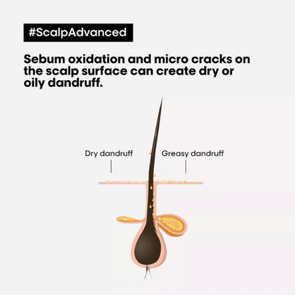 Serie Expert Scalp Advanced Anti-Dandruff Dermo-Clarifier Shampoo 300ml