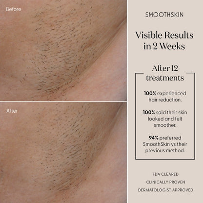SmoothSkin Pure Adapt - Advanced IPL Hair Removal Device - Green
